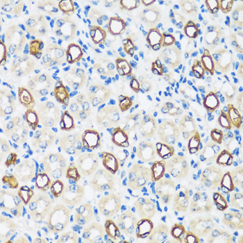 Immunohistochemistry - AQP2 Polyclonal Antibody 