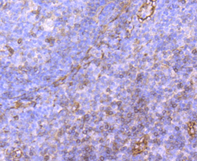 Fig2: Immunohistochemical analysis of paraffin-embedded human tonsil tissue using anti-CD62P antibody. Counter stained with hematoxylin.