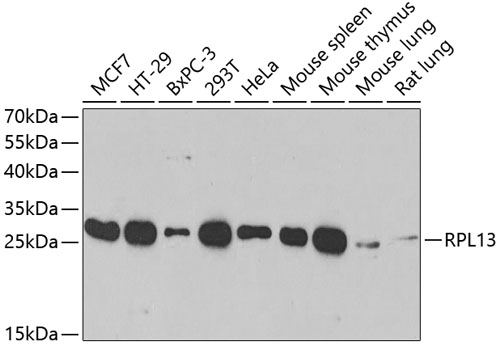 Western blot - RPL13 Polyclonal Antibody 