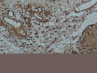 Immunohistochemical analysis of paraffin-embedded human-colon using antibody diluted at 1:50.