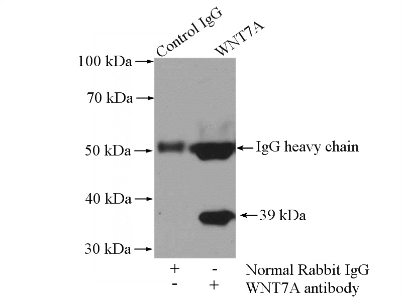 IP Result of anti-WNT7A (IP:Catalog No:116838, 4ug; Detection:Catalog No:116838 1:300) with mouse kidney tissue lysate 4000ug.