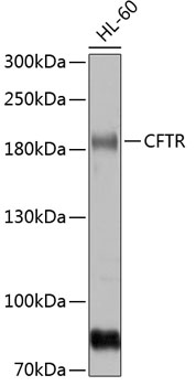 Western blot - CFTR Polyclonal Antibody 