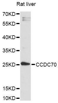 Western blot - CCDC70 Polyclonal Antibody 