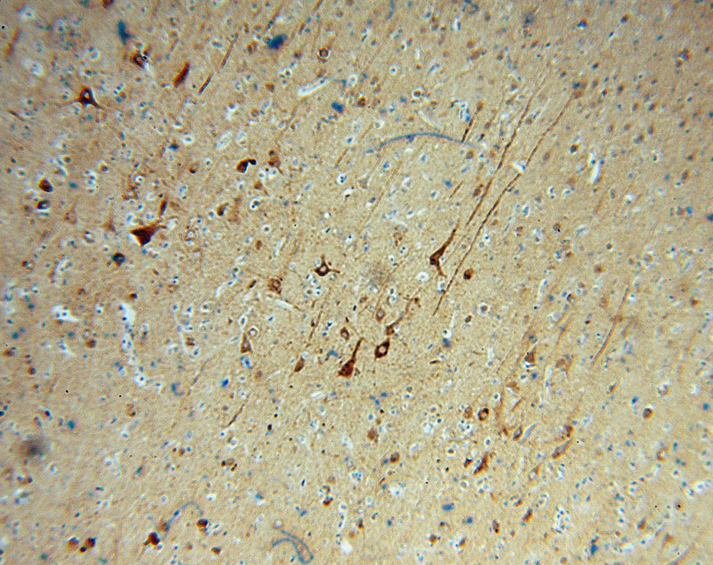 Immunohistochemical of paraffin-embedded human brain using Catalog No:110549(FBXO2 antibody) at dilution of 1:50 (under 10x lens)