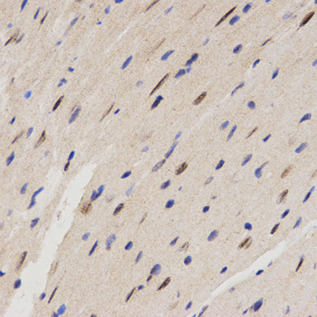 Immunohistochemistry - FAM160B2 Polyclonal Antibody 