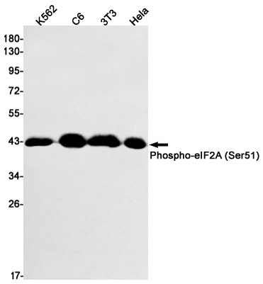 Western blot detection of Phospho-eIF2A (Ser51) in K562,C6,3T3,Hela cell lysates using Phospho-eIF2A (Ser51) Rabbit mAb(1:1000 diluted).Predicted band size:36kDa.Observed band size:36kDa.