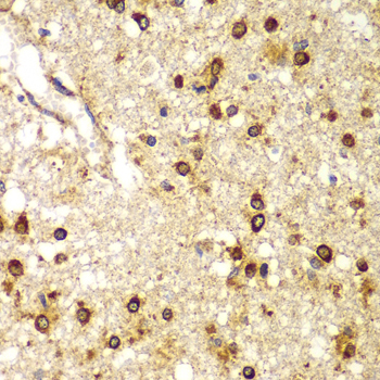 Immunohistochemistry - SMAD9 Polyclonal Antibody 