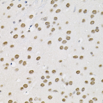 Immunohistochemistry - BAF60a Polyclonal Antibody 