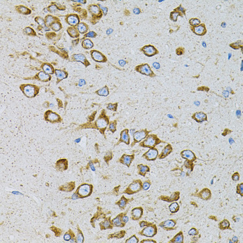 Immunohistochemistry - EEF1G Polyclonal Antibody 