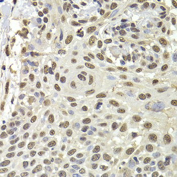 Immunohistochemistry - PUF60 Polyclonal Antibody 