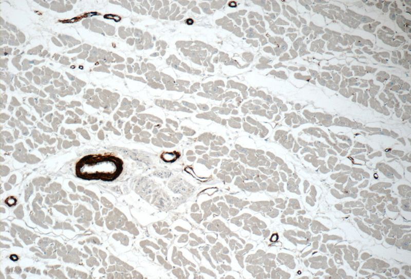 Immunohistochemistry of paraffin-embedded human heart tissue slide using Catalog No:116333(TAGLN Antibody) at dilution of 1:50 (under 10x lens)