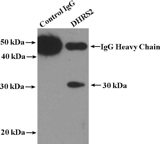 IP Result of anti-DHRS2 (IP:Catalog No:109923, 4ug; Detection:Catalog No:109923 1:300) with HeLa cells lysate 4000ug.