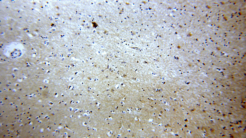 Immunohistochemical of paraffin-embedded human brain using Catalog No:112073(KLC1 antibody) at dilution of 1:100 (under 10x lens)