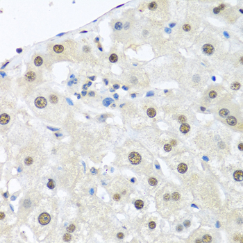 Immunohistochemistry - UBC Polyclonal Antibody 