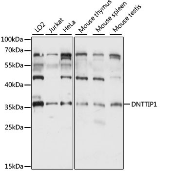 Western blot - DNTTIP1 Polyclonal Antibody 