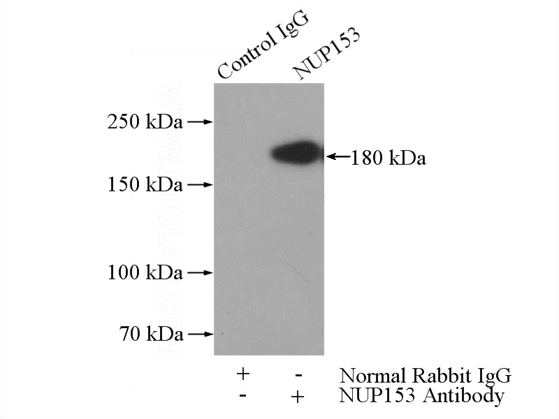 IP Result of anti-NUP153 (IP:Catalog No:113375, 4ug; Detection:Catalog No:113375 1:500) with K-562 cells lysate 3600ug.