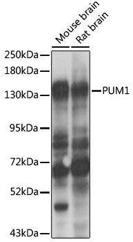 Western blot - PUM1 Polyclonal Antibody 