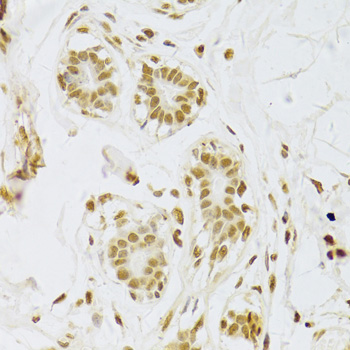 Immunohistochemistry - SNRPA Polyclonal Antibody 