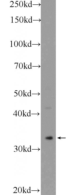 HEK-293 cells were subjected to SDS PAGE followed by western blot with Catalog No:109675(PPIE Antibody) at dilution of 1:1500