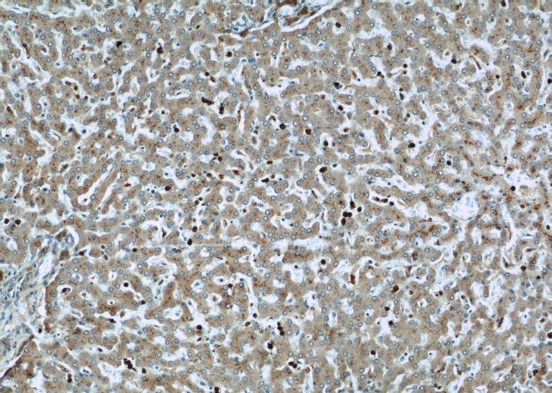 Immunohistochemical of paraffin-embedded human liver using Catalog No:112746(MPO antibody) at dilution of 1:50 (under 10x lens)