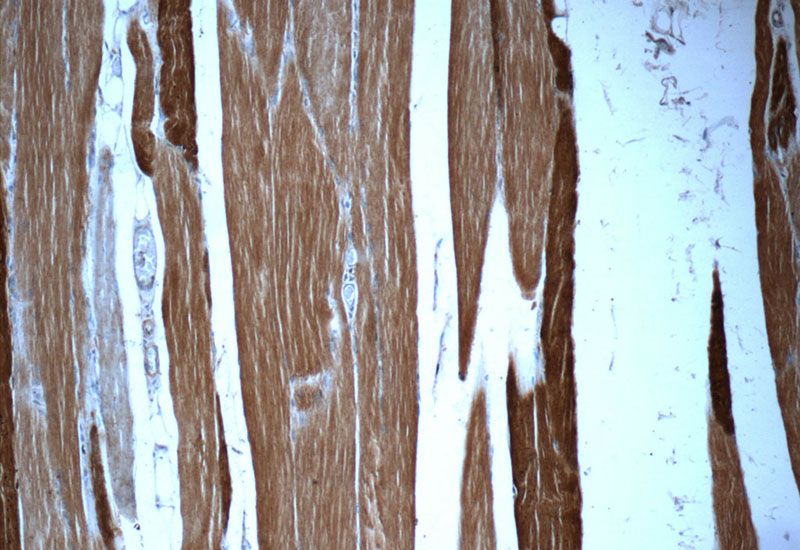 Immunohistochemistry of paraffin-embedded human skeletal muscle tissue slide using Catalog No:112976(MYLPF Antibody) at dilution of 1:50 (under 10x lens)