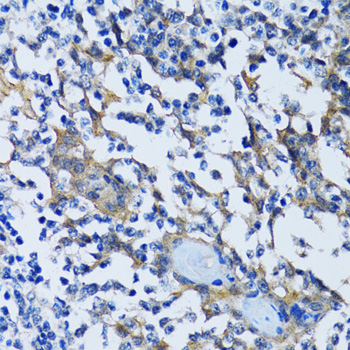 Immunohistochemistry - HDAC5 Polyclonal Antibody 