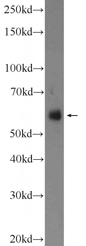 fetal human brain tissue were subjected to SDS PAGE followed by western blot with Catalog No:116747(SLC17A6 Antibody) at dilution of 1:600