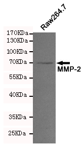 Western blot analysis of extracts from Raw264.7 cell lysates using MMP-2 mouse mAb (1:200 diluted). Predicted band size:64,72KDa. Observed band size:72KDa.