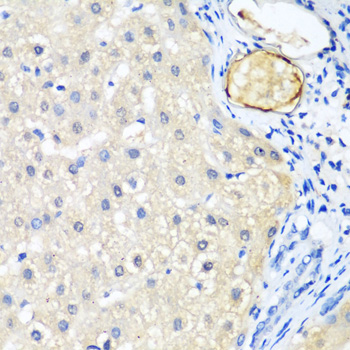 Immunohistochemistry - LRP5 Polyclonal Antibody 
