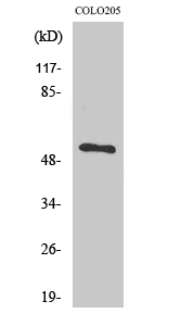 Fig1:; Western Blot analysis of various cells using TIGD3 Polyclonal Antibody. Secondary antibody（catalog#: HA1001) was diluted at 1:20000 cells nucleus extracted by Minute TM Cytoplasmic and Nuclear Fractionation kit (SC-003,Inventbiotech,MN,USA).