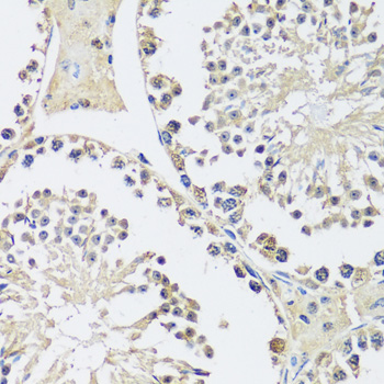 Immunohistochemistry - C12orf10 Polyclonal Antibody 
