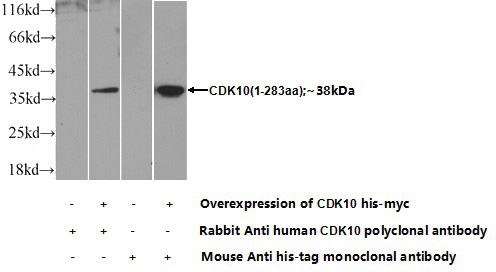 Transfected HEK-293 cells were subjected to SDS PAGE followed by western blot with Catalog No:109156(CDK10 Antibody) at dilution of 1:700
