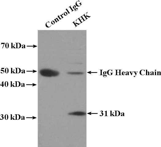 IP Result of anti-KHK (IP:Catalog No:112039, 4ug; Detection:Catalog No:112039 1:500) with mouse liver tissue lysate 4000ug.