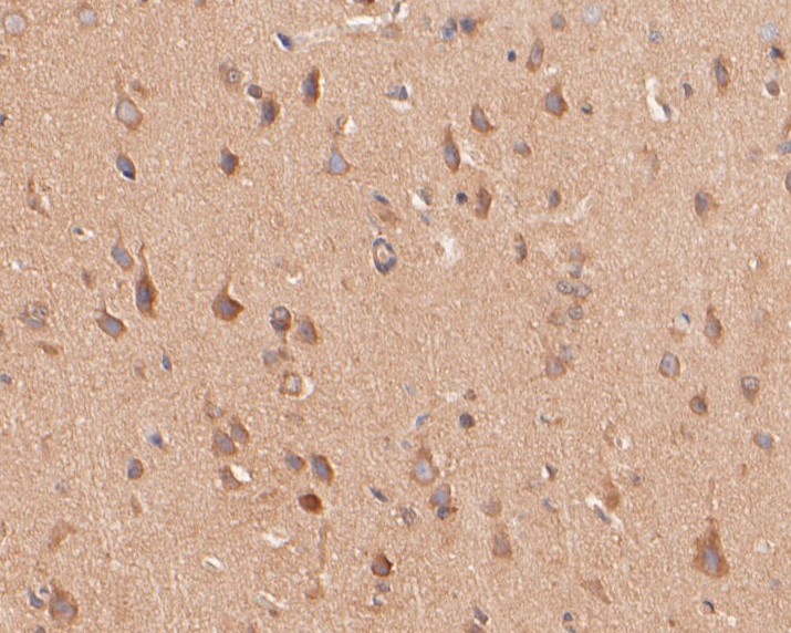 Fig2:; Immunohistochemical analysis of paraffin-embedded rat brain tissue using anti-KV2.2 antibody. The section was pre-treated using heat mediated antigen retrieval with Tris-EDTA buffer (pH 8.0-8.4) for 20 minutes.The tissues were blocked in 5% BSA for 30 minutes at room temperature, washed with ddH; 2; O and PBS, and then probed with the primary antibody ( 1/50) for 30 minutes at room temperature. The detection was performed using an HRP conjugated compact polymer system. DAB was used as the chromogen. Tissues were counterstained with hematoxylin and mounted with DPX.