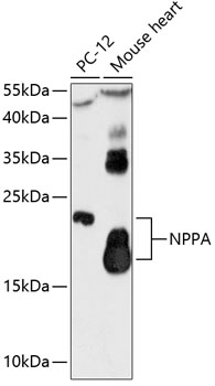 Western blot - NPPA Polyclonal Antibody 