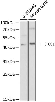 Western blot - DKC1 Polyclonal Antibody 