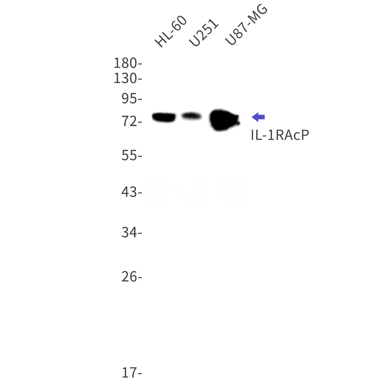 Western blot detection of IL-1RAcP in HL-60,U251,U87-MG cell lysates using IL-1RAcP Rabbit mAb(1:1000 diluted).Predicted band size:65kDa.Observed band size:78kDa.