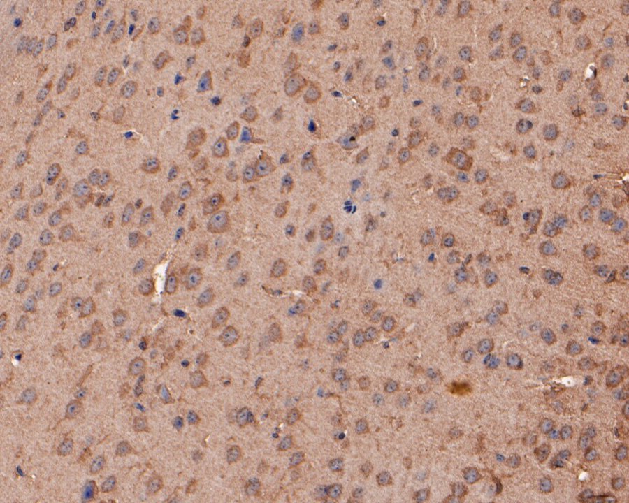 Fig3:; Immunohistochemical analysis of paraffin-embedded mouse brain tissue using anti-VLDL Receptor antibody. The section was pre-treated using heat mediated antigen retrieval with Tris-EDTA buffer (pH 8.0-8.4) for 20 minutes.The tissues were blocked in 5% BSA for 30 minutes at room temperature, washed with ddH; 2; O and PBS, and then probed with the primary antibody ( 1/100) for 30 minutes at room temperature. The detection was performed using an HRP conjugated compact polymer system. DAB was used as the chromogen. Tissues were counterstained with hematoxylin and mounted with DPX.