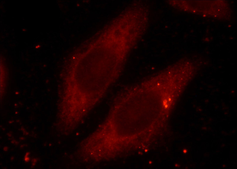 Immunofluorescent analysis of HeLa cells using Catalog No:114440(RAB3A-specific Antibody) at dilution of 1:25 and Rhodamine-Goat anti-Rabbit IgG