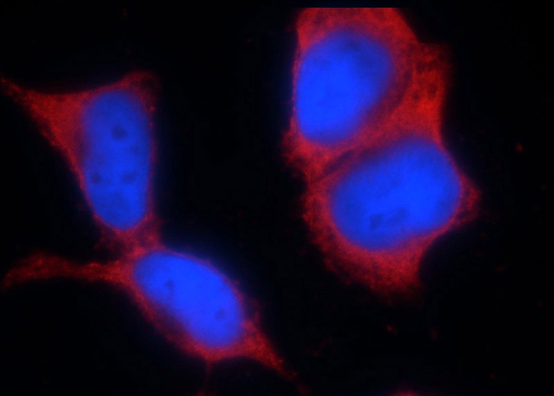 Immunofluorescent analysis of HEK-293 cells using Catalog No:113417(ORAI2 Antibody) at dilution of 1:25 and Rhodamine-Goat anti-Rabbit IgG
