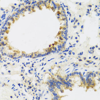 Immunohistochemistry - UVRAG Polyclonal Antibody 
