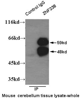IP result of anti-ZNF238 (Catalog No:116963 for IP and Detection) with mouse cerebellum tissue.