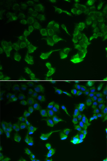 Immunofluorescence - C1R Polyclonal Antibody 