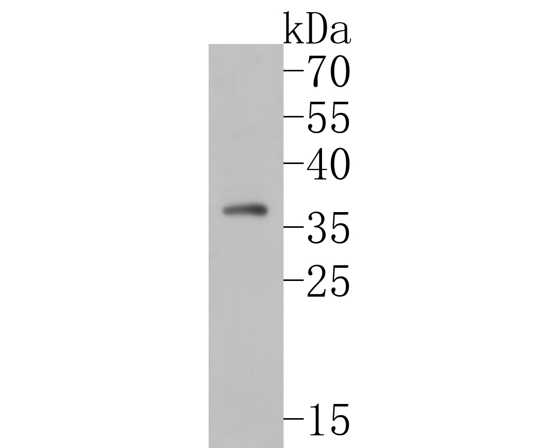 Fig1:; Western blot analysis of TMX4 on rat cerebellum tissue lysates. Proteins were transferred to a PVDF membrane and blocked with 5% BSA in PBS for 1 hour at room temperature. The primary antibody ( 1/500) was used in 5% BSA at room temperature for 2 hours. Goat Anti-Rabbit IgG - HRP Secondary Antibody (HA1001) at 1:5,000 dilution was used for 1 hour at room temperature.