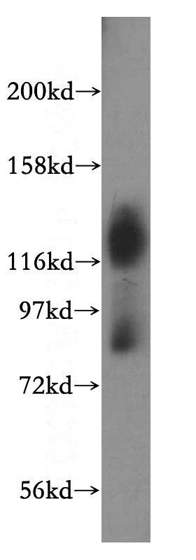 HeLa cells were subjected to SDS PAGE followed by western blot with Catalog No:109087(SLC3A2 antibody) at dilution of 1:500