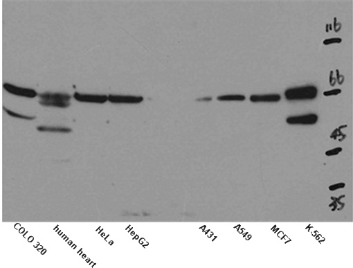 WB result of anti-KCNA2 (Catalog No:112255) in different cell and tissue lysates.