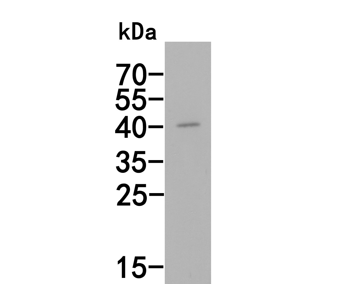 Fig1:; Western blot analysis of AIM2 on Hela cell lysates. Proteins were transferred to a PVDF membrane and blocked with 5% NFDM/TBST for 1 hour at room temperature. The primary antibody ( 1/500) was used in 5% NFDM/TBST at room temperature for 2 hours. Goat Anti-Rabbit IgG - HRP Secondary Antibody (HA1001) at 1:200,000 dilution was used for 1 hour at room temperature.