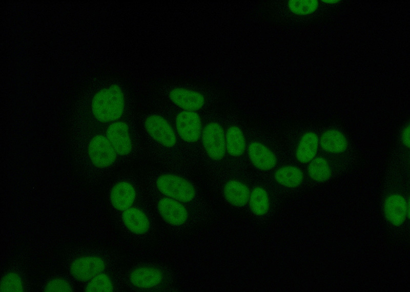 Immunofluorescent analysis of (10% Formaldehyde) fixed HepG2 cells using Catalog No:107641(TKT Antibody) at dilution of 1:100 and Alexa Fluor 488-congugated AffiniPure Goat Anti-Mouse IgG(H+L)