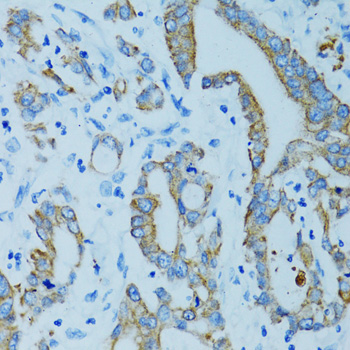 Immunohistochemistry - KRT15 Polyclonal Antibody 
