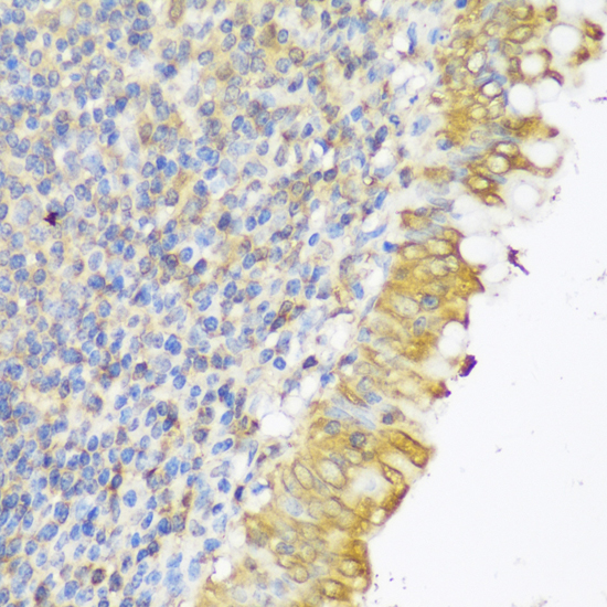 Immunohistochemistry - GLB1L3 Polyclonal Antibody 